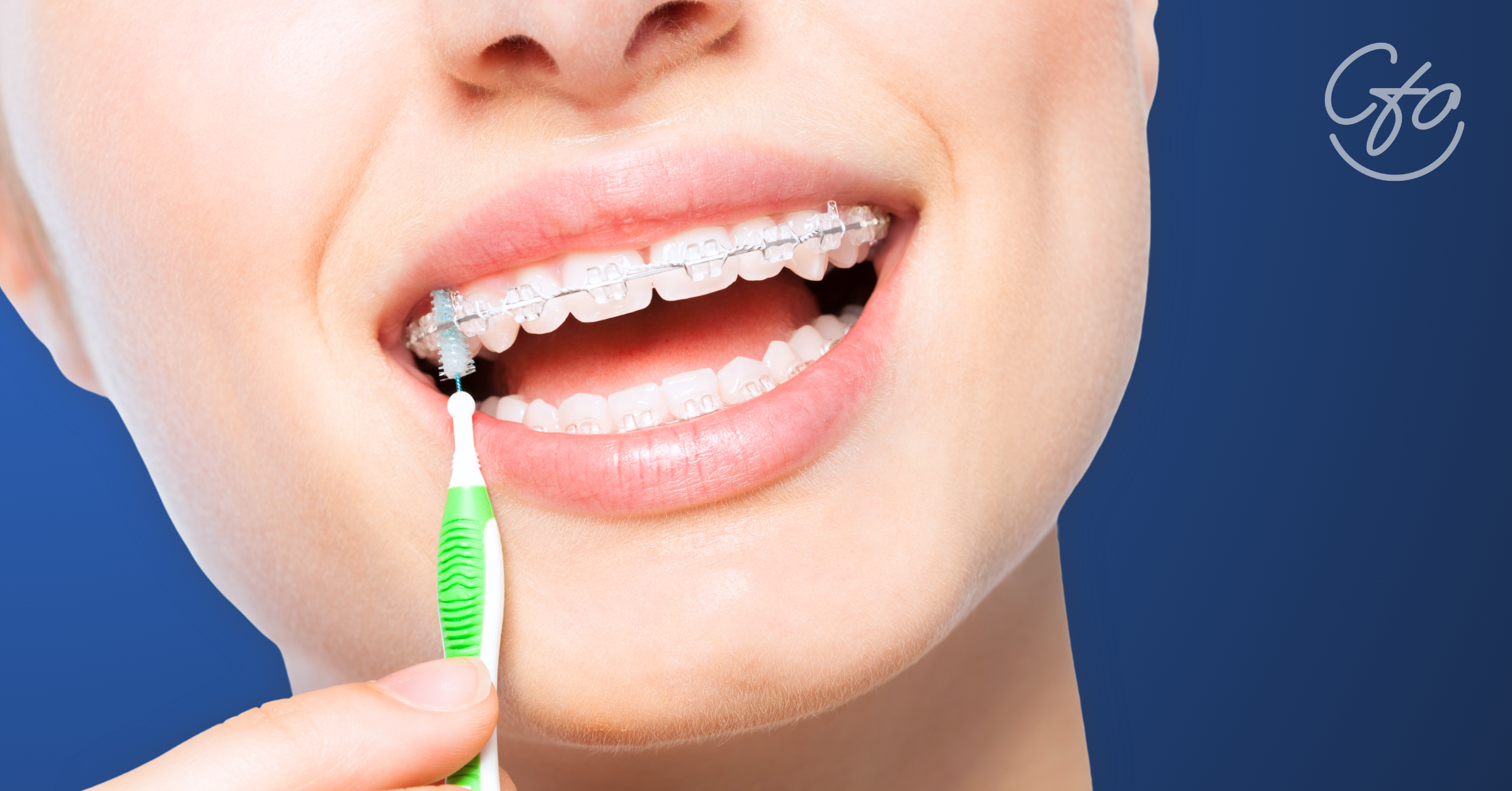 Close-up of person showing how to Clean Braces